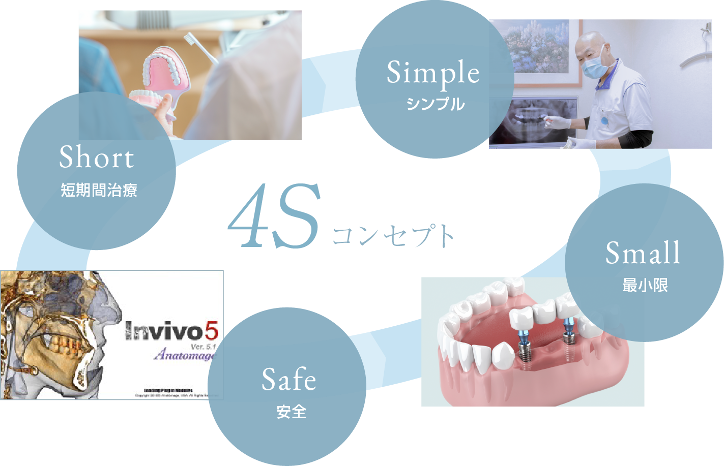4Sコンセプト